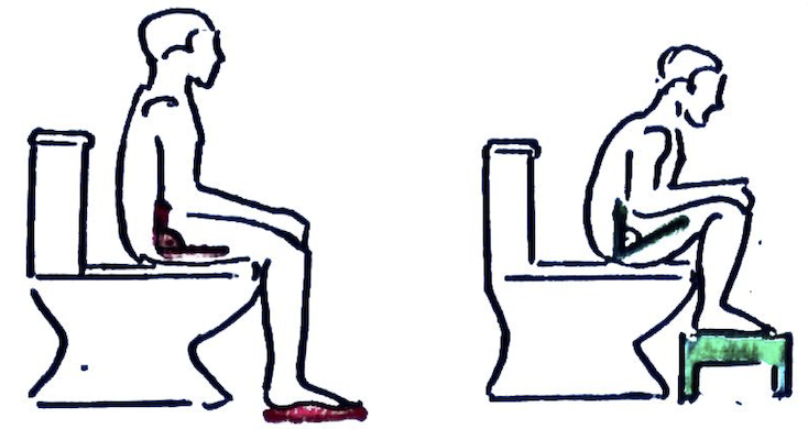 Defecation Position 12 Tricks To Beat Constipation - Dr Christian Jeske