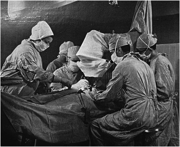Microsurgery using an operating microscope